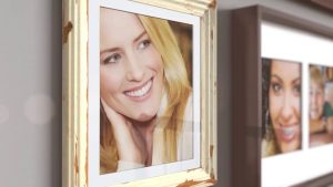 Empower Self Ligating Braces